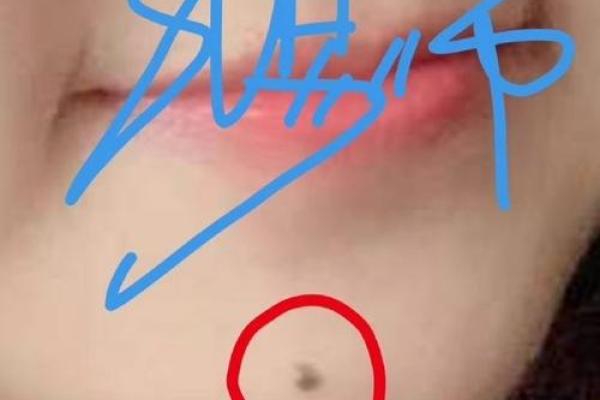 臀部痣相与命运：揭示女性潜藏的性格特征