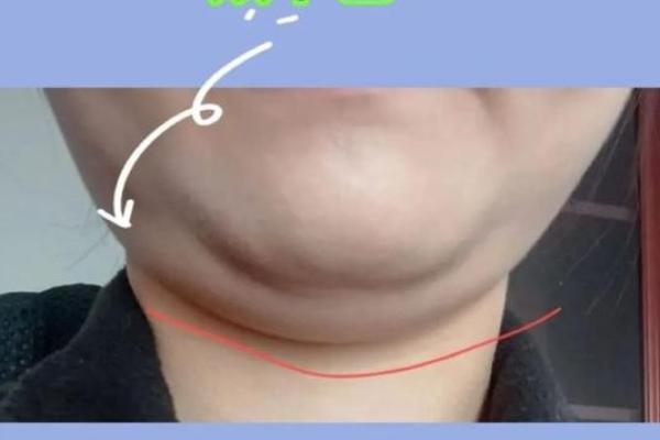 短下巴面相女性的命运玄机及性格特征揭秘