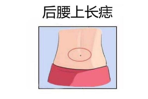 从男人痣相看爱情运：你身上的痣暗示了什么感情走向