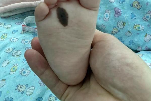 后脑长痣的意义与性格特点