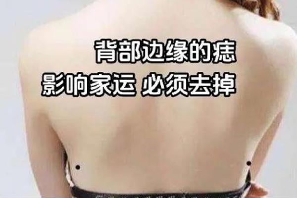 男孩背上痣的形状与未来运势