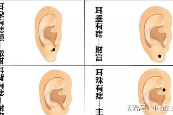 耳朵痣相与健康、财富、感情的潜在联系 耳朵痣相与健康、财富、感情的潜在联系