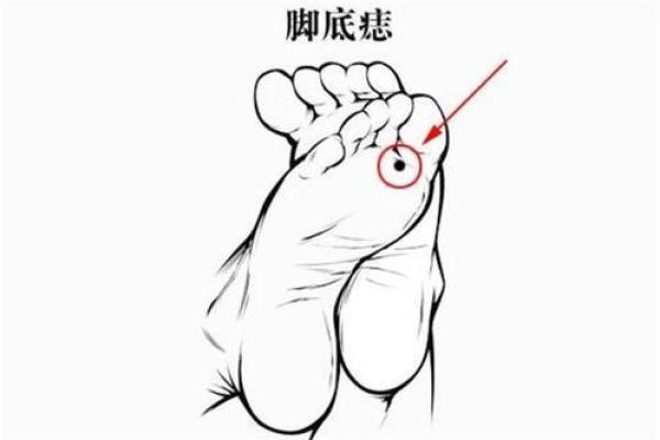 痣相女脚揭示的命运特征与性格解析
