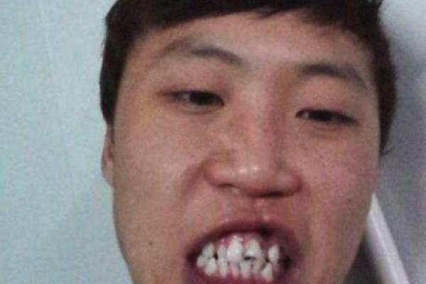 吹火嘴面相解析：揭秘你性格中的冲动与决断力