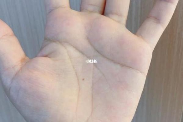 手心有痣相解析：运势与命运的深层联系