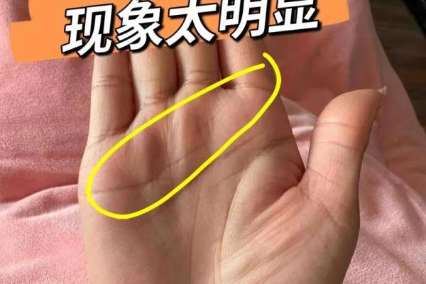 手相中的元宝纹:象征富贵与好运 手相中的元宝纹:象征富贵与好运