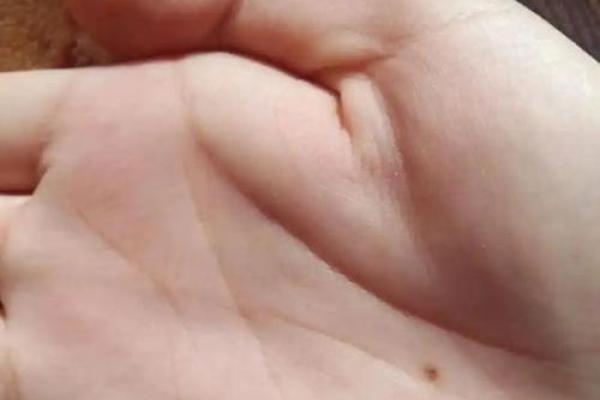 官运亨通的痣相有哪些显著特征 官运亨通的痣相有哪些显著特征