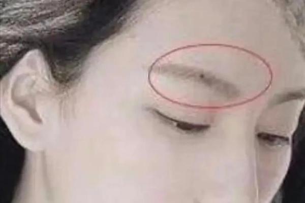 官运亨通的痣相有哪些显著特征 官运亨通的痣相有哪些显著特征