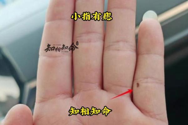 玄学痣相入门：如何通过痣相解读个人人生密码