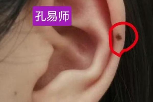 耳朵上的痣相与命运的关系解读