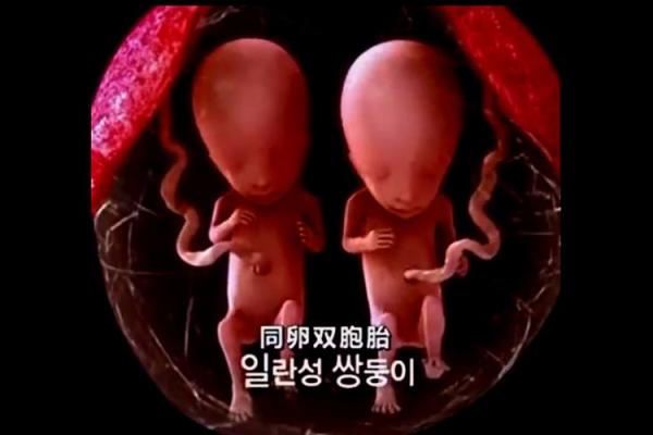 双胞胎取名时如何避免常见的错误和陷阱