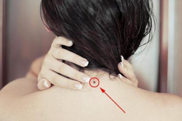 女人脖子上的痣与性格命运的关系