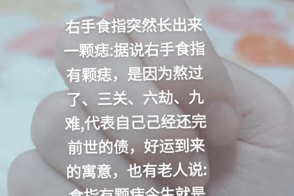 了解手上痣的位置，揭示你未来的生活走向