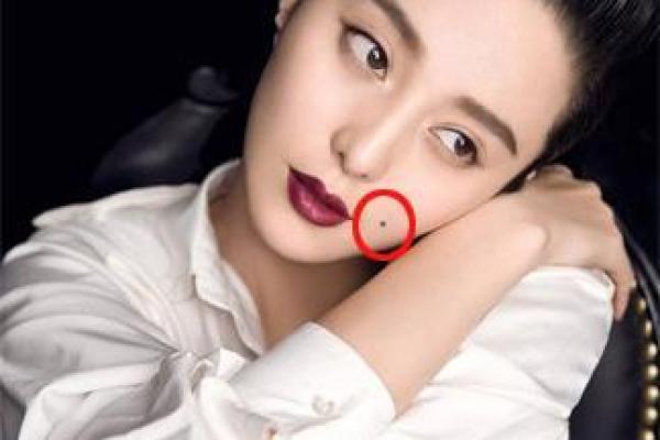 胸口痣的象征意义与人生运势关系