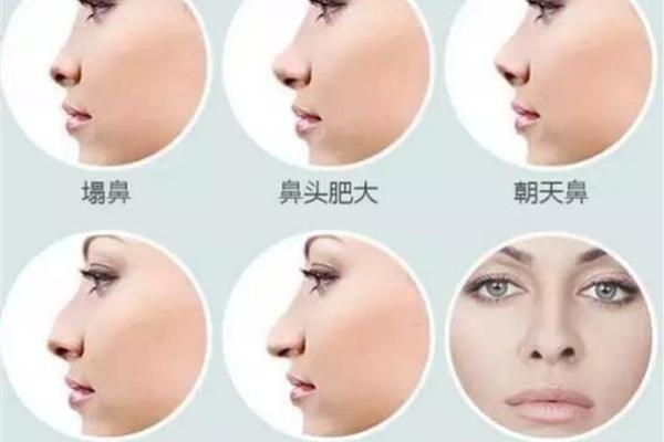 从朝天鼻面相看你的人生潜力与运势走势