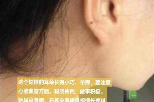 耳朵痣的位置与命运，解读五大常见痣相