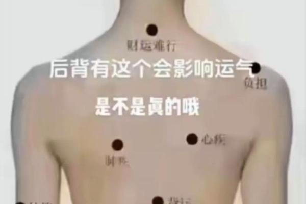 腰侧痣相大揭秘：它是你命运的幸运符吗？