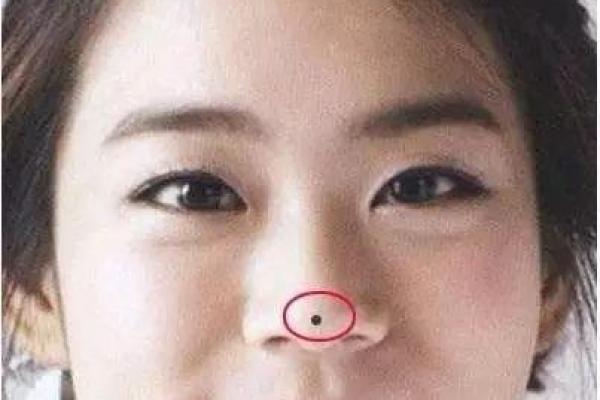 天生丽质，左鼻翼痣相女魅力难挡