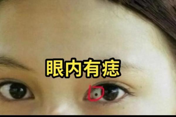 面相痣相大揭秘：这样的痣相，桃花运让人羡慕不已！