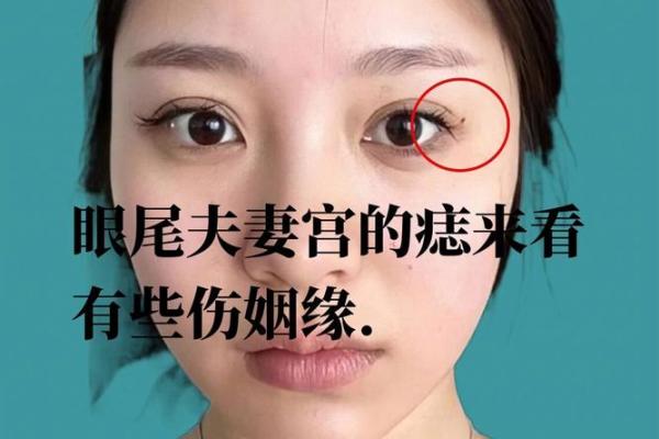 痣相流泪，运势大反转？揭秘流泪痣的神奇力量