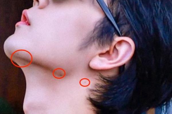 痣是他的幸运符？这位男星全身痣相成焦点！