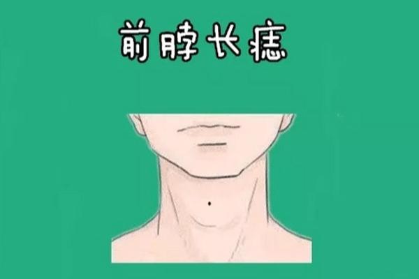 神秘脖后左痣：揭示你的命运密码