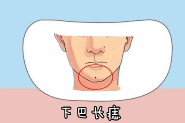 痣相中的水厄信号：提前预防，远离不幸