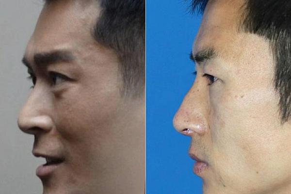 鼻尖翘面相男人的独特魅力