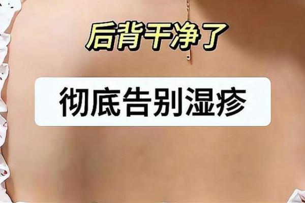 家居风水大揭秘：湿疹克星，让你告别皮肤不适