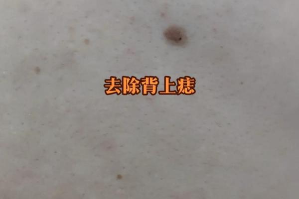 点痣成星：揭秘脸部痣的神奇魅力