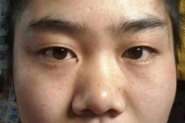 高额头女性的独特面相魅力