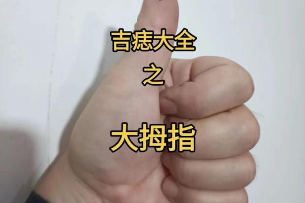 手指背痣：传说中的幸运符，真的存在吗？
