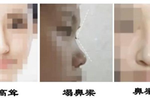 山根长面相：运势亨通，财富滚滚！