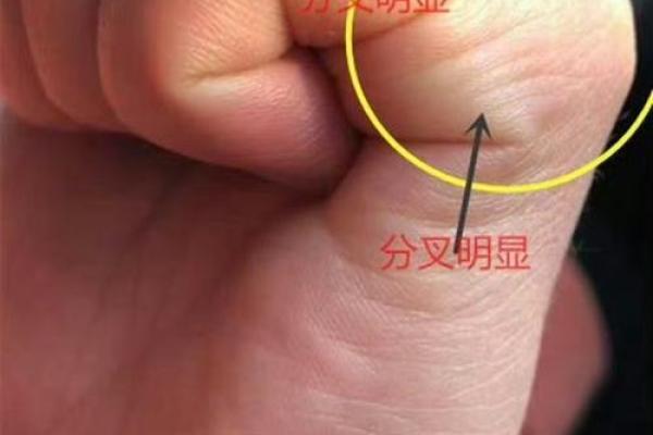 手相揭秘：红点预示着怎样的命运？