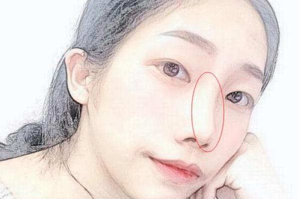 鼻梁弯弯，运势如何？面相揭秘！