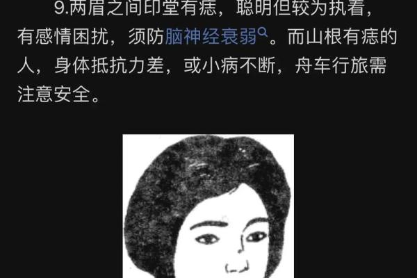 贵妇痣相：揭秘命运之痣的神秘魅力