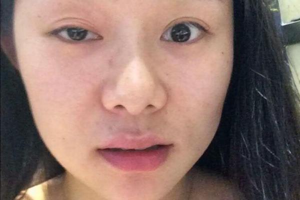 面相揭秘：眼皮大面相的神秘魅力
