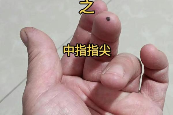 小指第一关节痣，是你的命中贵人吗？
