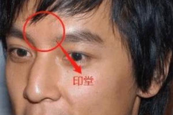 印堂恶痣真的存在？揭秘其背后的惊人真相！
