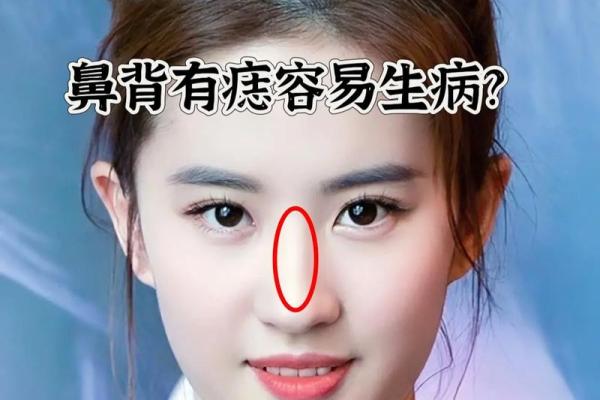 独一无二的鼻痣魅力