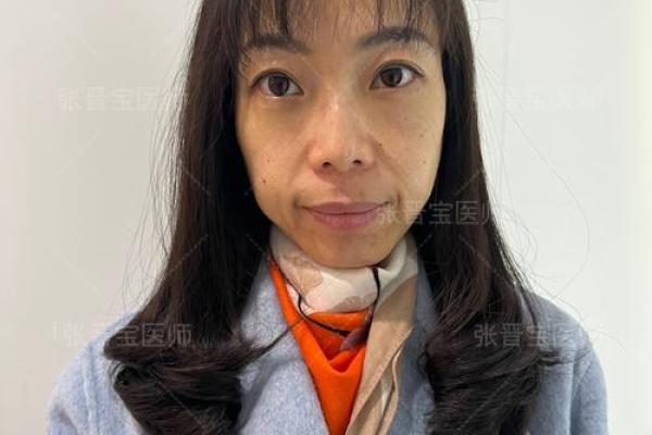 眼袋青隐，命运沉浮的面相密码