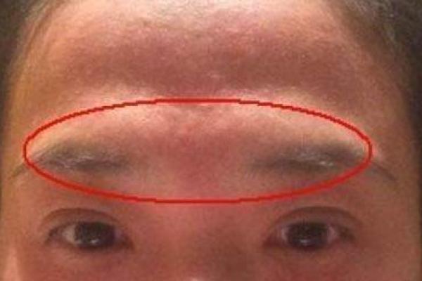 面相揭秘：颧骨塌面预示着怎样的命运转折？
