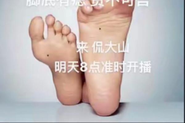 独一无二的手足痣，带你领略个性之美