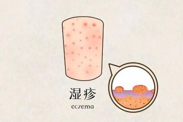 湿疹克星！家居风水布局让你舒适生活无忧