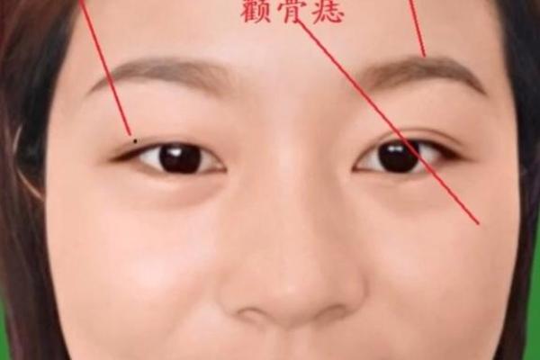 鼻痣揭秘：哪些痣相预示着好运连连？