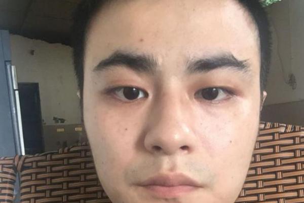 眉毛逆生之谜