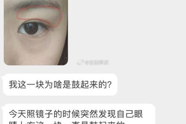 眼皮横纹：揭示命运转折的神秘面相之谜