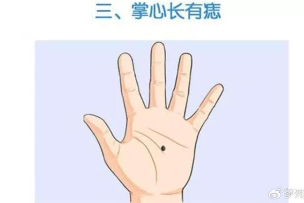 左手指痣：揭秘隐藏的运势密码
