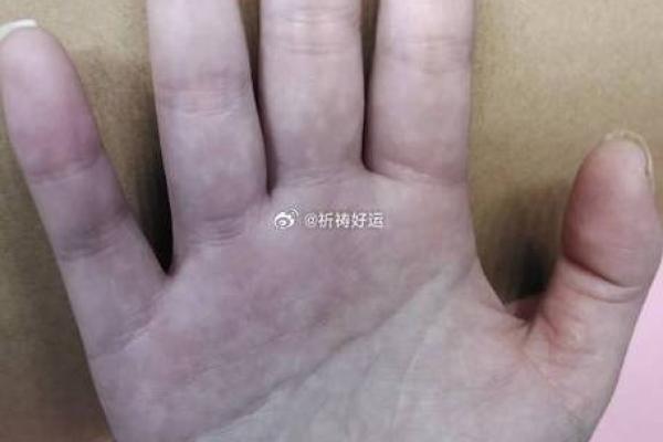 解锁命运密码：揭秘最准手相绝学！