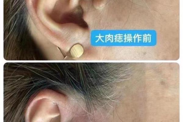 神秘痣相：耳唇相带，魅力无限！